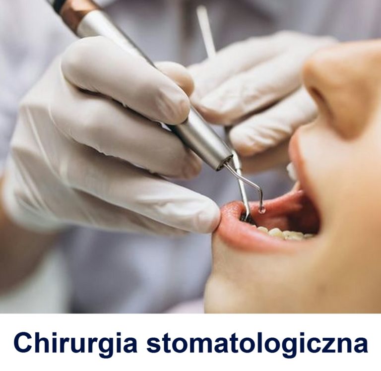 Chirurgia stomatologiczna Gdańsk